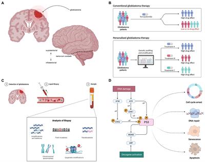 Personalised therapeutic approaches to glioblastoma: A systematic review